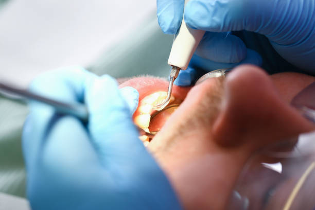 Best Emergency Treatment for Oral Infections in Gloversville, NY